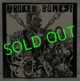 BROKEN BONES/ Dem Bones[LP]